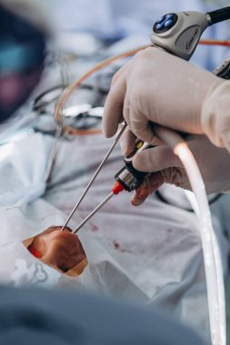 03.09.2019 Vinnitsa, Ukrayna: Hastanede asgari invazif cerrahi müdahaleler yapan cerrahlardan oluşan tıbbi ekip. Kardiyovasküler acil ameliyat merkezi için elektrokoterapi ekipmanlarıyla ameliyathane