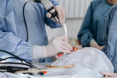03.09.2019 Kyiv, Ukrayna: Endoskopik sinüs ameliyatı. Burun kabuğunun lazer buharlaşması. Modern tıbbi ekipmanlar. Cerrahların takım çalışması gerçek bir operasyonda. Seçici odak, gürültü etkisi