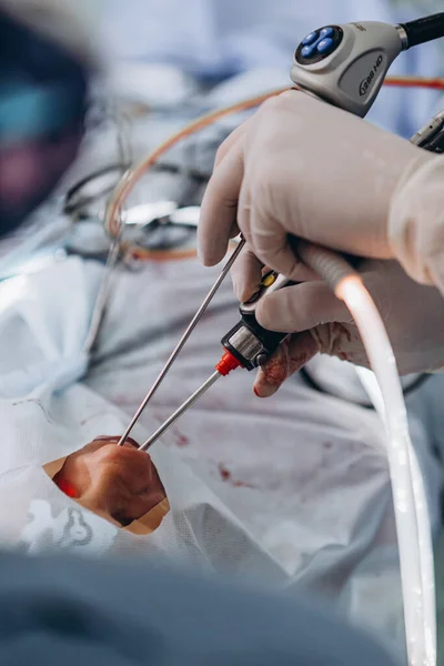 2019 Vinnitsa Ukraine Medical Team Surgeons Hospital Doing Minimal Invasive — Stock Photo, Image