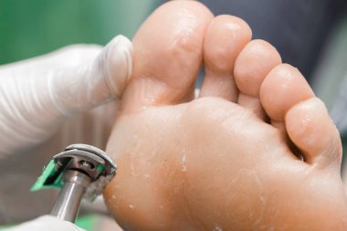 Pedikür yordamda Güzellik Salonu. üzerinde emover Nasır