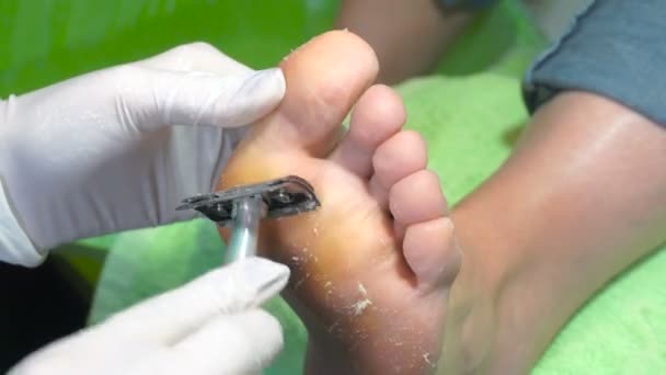 Procedimiento de pedicura en el salón de belleza. emover callos en los pies . — Vídeo de stock