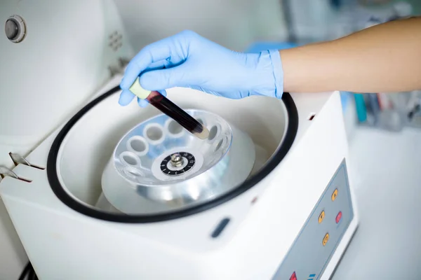 Plasmolifting. Preparación de sangre para preparaciones inyectables. cosmetólogo pone tubo de sangre en centrifugadora — Foto de Stock