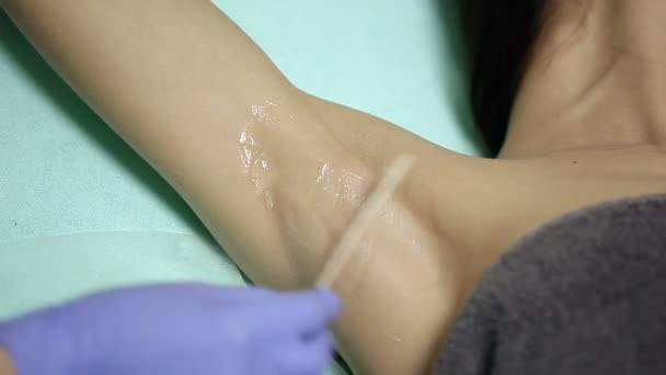 Cosmetologist aplica o gel às axilas do paciente antes do procedimento epilation — Vídeo de Stock