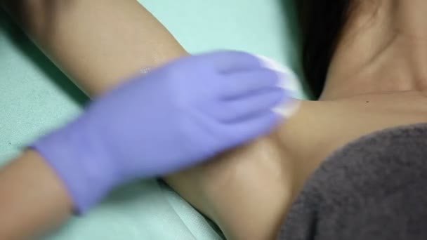 El cosmetólogo limpia las axilas de los pacientes con esponja de algodón antes del procedimiento. desinfección — Vídeo de stock