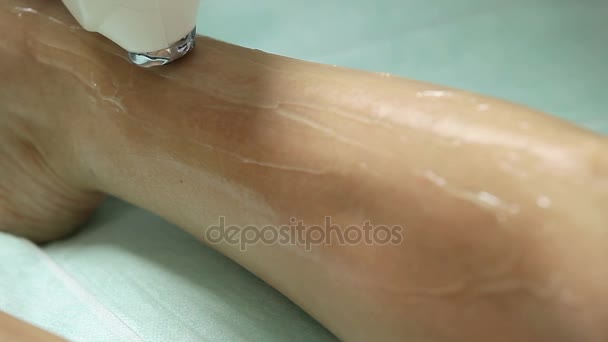 Kosmetikerin führt Laser-Haarentfernung an den Beinen des Patienten durch. Epilationsverfahren — Stockvideo