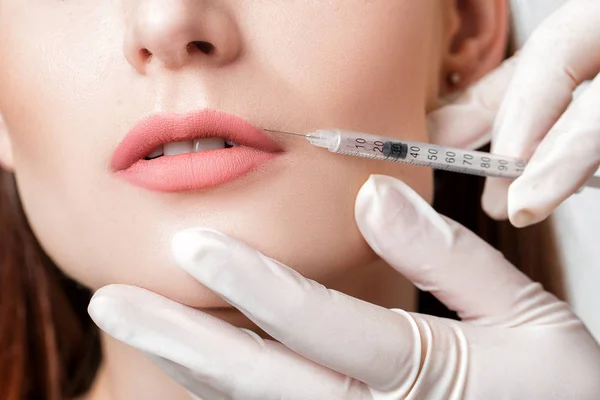 Woman getting injection on lips. — Stock Photo, Image
