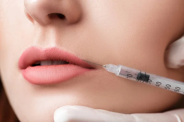 Mujer recibiendo inyección en los labios . —  Fotos de Stock
