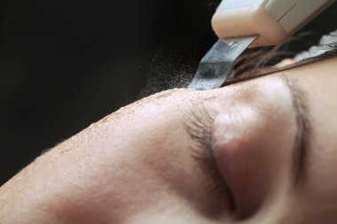 kadın yüz cilt scrubber tedavisi ultrasonik spatula ile