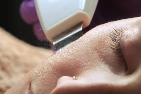 Kvinna ansikte skin scrubber behandling med ultraljud spatel — Stockfoto