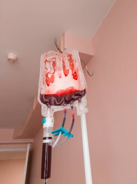 Operasyonun son aşamasında kan nakli. Neredeyse boş bir kan torbası. Dikey fotoğraf