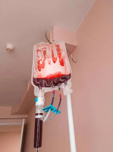 Operasyonun son aşamasında kan nakli. Neredeyse boş bir kan torbası. Dikey fotoğraf