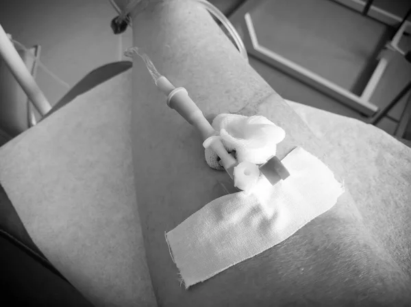 Intraveneuze Katheter Hand Van Patiënt Invoering Van Geneesmiddelen Voor Verschillende — Stockfoto