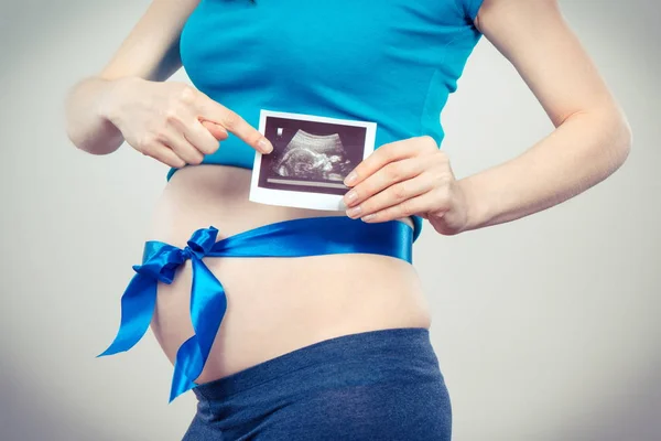 Zwangere vrouw met blauw lint tonen echografie scan van de baby, concept van verwachten voor pasgeboren — Stockfoto