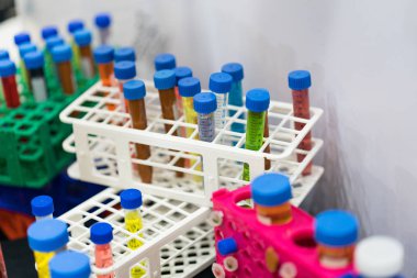 Yüksek teknoloji plastik imalat sanayi