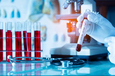 Covid-19 veya nCoV Coronavirus testi pozitif.