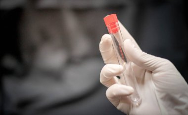 Doktor el test tüpünü tutuyor ve ameliyat eldiveni giyiyor. Laboratuvar odasındaki deney için hazırlanıyor.. 