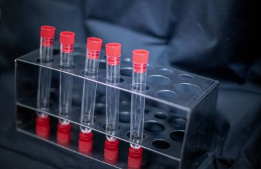 Laboratuvar deney tüpleri bilim adamı için kullanılıyor. Bilim odası ve laboratuvar odası için.. 