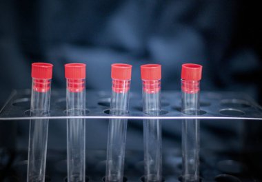 Laboratuvar deney tüpleri bilim adamı için kullanılıyor. Bilim odası ve laboratuvar odası için.. 