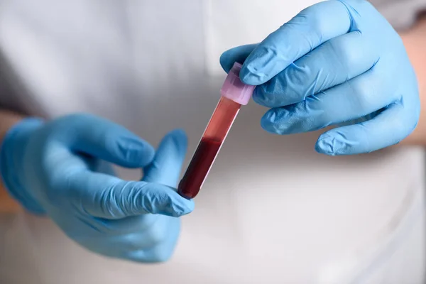 Doctor Hands Holding Test Tube Blood Sample Research New Rapidly — Stock Photo, Image