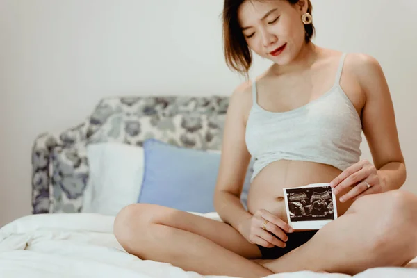 Hamile bir kadın 16 haftalık bebek röntgenine bakıyor.