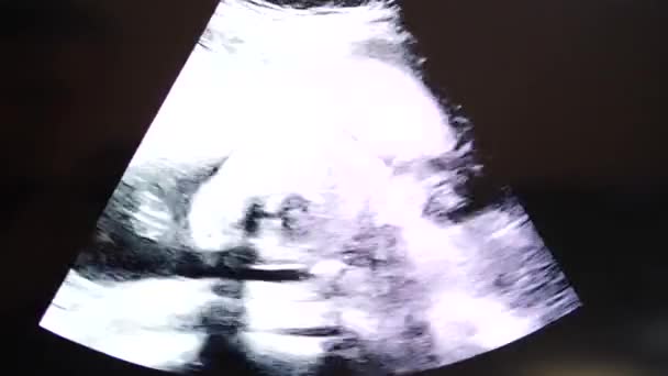 Ecografia bambino scansione di incinta donna in mostra — Video Stock