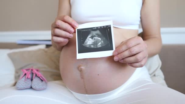 Mujer embarazada sosteniendo foto de exploración por ultrasonido en el vientre — Vídeos de Stock
