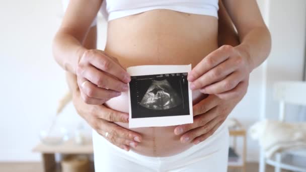 Muž a těhotná žena drží ultrazvuk fotografie na břiše. — Stock video