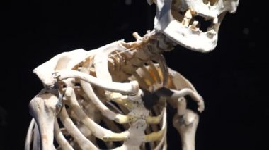 İnsan Anatomisi Omurga Hastalığı Olan Gerçek İskelet