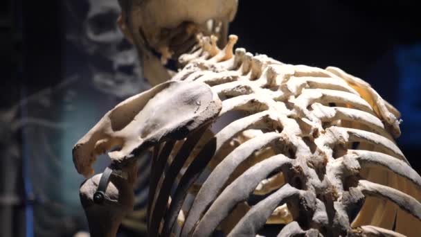 Menschliches Skelett mit Wirbelsäulenerkrankungen: Arthritis, Arthrose, Osteoporose, degenerative Bandscheibenerkrankung, Krümmung, Skoliose — Stockvideo