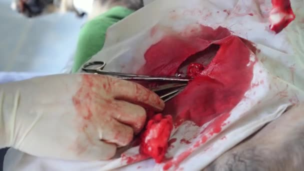 Klinikte Kapatma Ameliyatı — Stok video