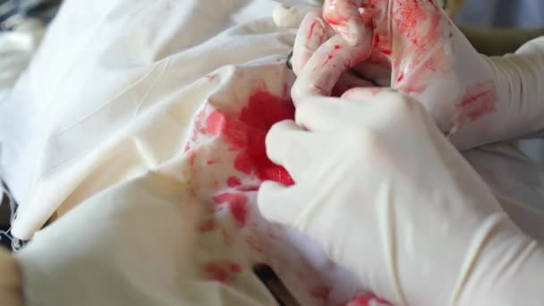 Close Up of Bloody Surgery — Stock Video