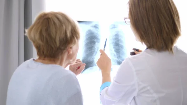 Orvos elmagyarázza röntgen eredmények vezető beteg — Stock Fotó