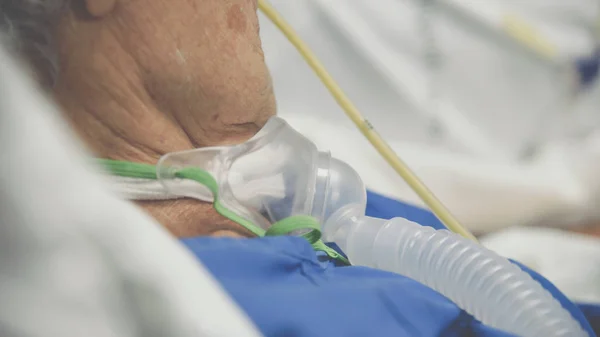 Patient macht Tracheostomie und Beatmungsgerät im Krankenhaus — Stockfoto