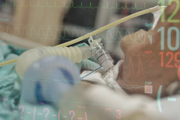 Paciente hace traqueostomía y ventilador en el hospital — Foto de Stock