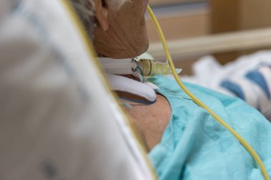 Hasta yapmak trakeostomi ve hastanede solunum