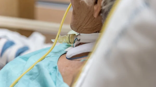 Patient macht Tracheostomie und Beatmungsgerät im Krankenhaus — Stockfoto