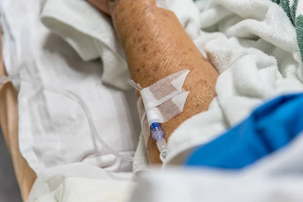 Patient im Krankenhaus mit intravenöser Kochsalzlösung — Stockfoto