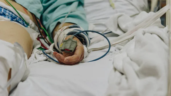 Patient in the hospital with pulse gauge on finger — Stock Photo, Image