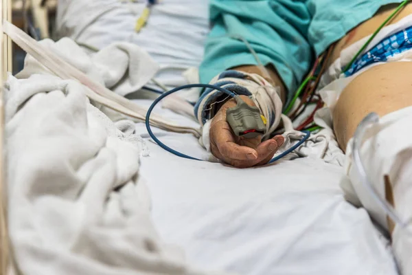 Paciente en el hospital con pulsiómetro en el dedo —  Fotos de Stock
