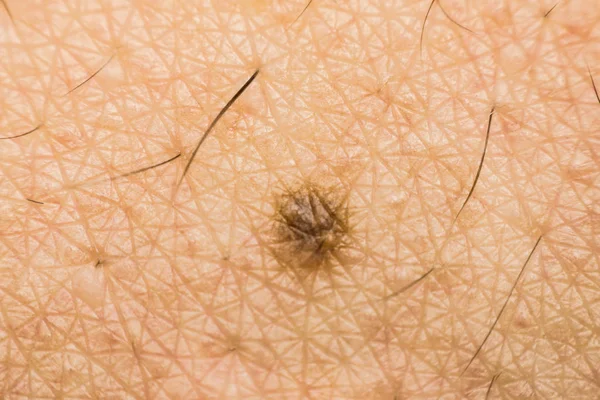 Macro of dry skin asian human with dermatology