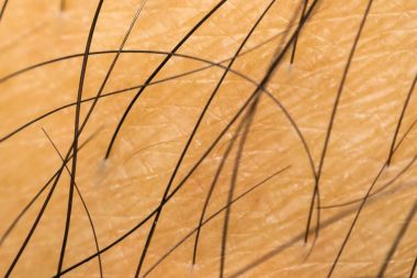 Makro siyah kıllı Asya insan kuru cilt