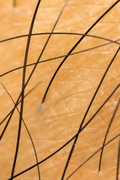 Makro siyah kıllı Asya insan kuru cilt