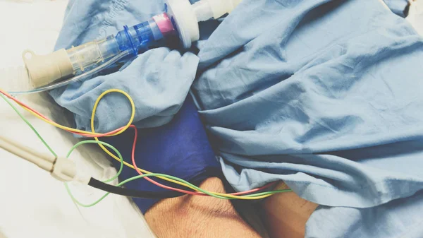 病人做气管切开、 呼吸机在医院 — 图库照片