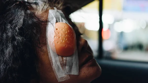 Paciente asiático mulheres mostrar seus olhos com olho escudo — Fotografia de Stock