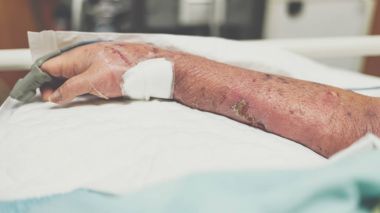 Darbe ile hastanede hasta parmağında ölçmek