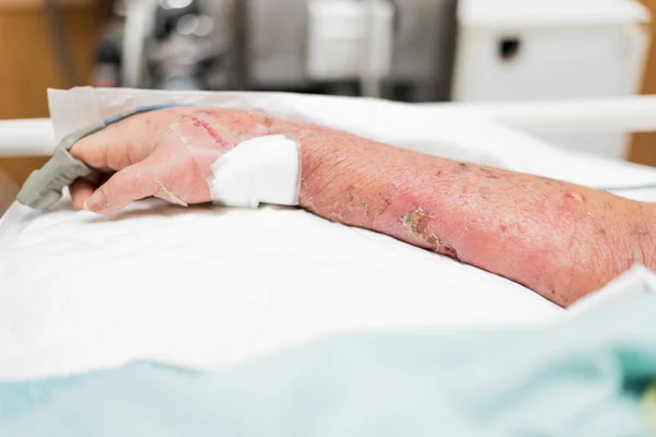 Paciente no hospital com pulso medidor no dedo — Fotografia de Stock