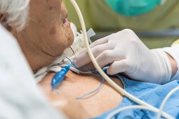 Paciente hace traqueostomía y ventilador en el hospital — Foto de Stock