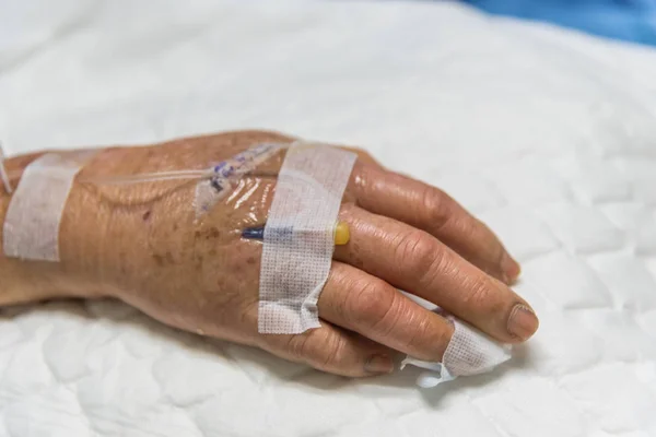 Beteg a kórházban, intravénás sóoldattal — Stock Fotó
