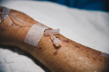 İntravenöz serum fizyolojik ile hastanede hasta