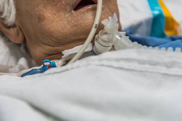 患者は気管切開と人工呼吸器の病院で — ストック写真